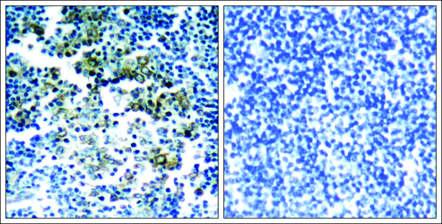 Anti-phospho-BCR (pTyr177) antibody produced in rabbit affinity isolated antibody