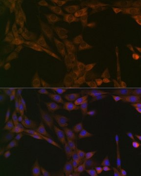 Anti-SMYD3 antibody produced in rabbit