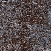 Monoclonal Anti-CD5 antibody produced in mouse Prestige Antibodies® Powered by Atlas Antibodies, clone CL12334, purified immunoglobulin, buffered aqueous glycerol solution