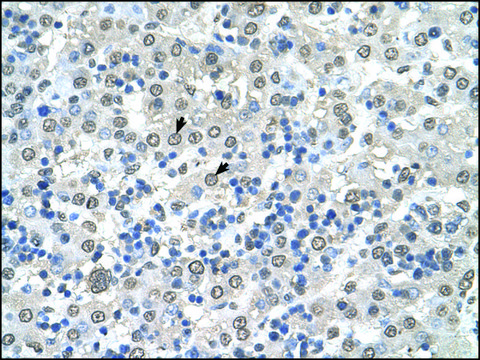 Anti-CDR2 antibody produced in rabbit IgG fraction of antiserum