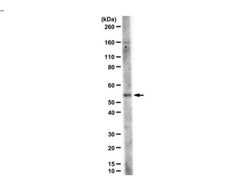 Anti-VPS4B (UT292) serum, from rabbit