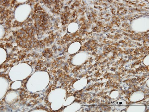 Monoclonal Anti-CAMK2B antibody produced in mouse clone S11, purified immunoglobulin, buffered aqueous solution