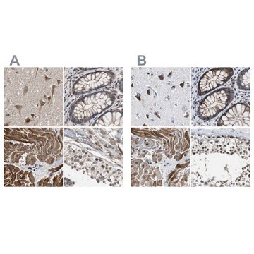 Anti-PITRM1 antibody produced in rabbit Ab1, Prestige Antibodies&#174; Powered by Atlas Antibodies, affinity isolated antibody, buffered aqueous glycerol solution