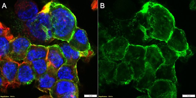 Anti-L1CAM/CD171 Antibody, clone S10.33