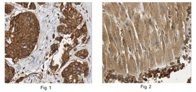 Anti-Rab7A, clone 5G8.1 Antibody clone 5G8.1, 0.5&#160;mg/mL, from mouse