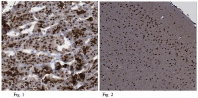 抗-MNX1 （HB9）抗体 from rabbit, purified by affinity chromatography