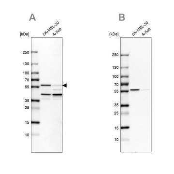 Anti-PHGDH antibody produced in rabbit Prestige Antibodies&#174; Powered by Atlas Antibodies, affinity isolated antibody, buffered aqueous glycerol solution, Ab2