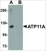 Anti-ATP11A antibody produced in rabbit affinity isolated antibody, buffered aqueous solution
