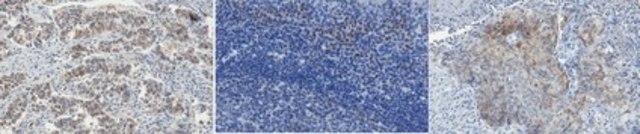 Anti-asparagine synthetase Antibody, clone Z5808 clone Z5808, from mouse