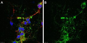 Anti-Aggrecan Core Protein Antibody, clone Cat-315