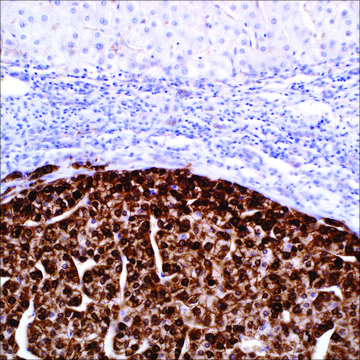 Glutamine Synthetase (GS-6) Mouse Monoclonal Antibody