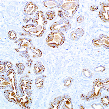 Cytokeratin, LMW (AE1) Mouse Monoclonal Antibody