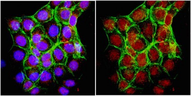 Anti-FOXP3 Antibody serum, from rabbit