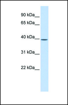 Anti-MAT2B, (N-terminal) antibody produced in rabbit affinity isolated antibody