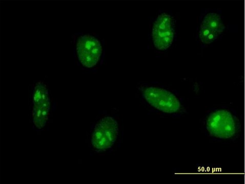 Monoclonal Anti-EXOSC5 antibody produced in mouse clone 6G11, purified immunoglobulin, buffered aqueous solution