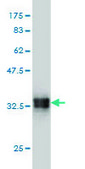 Monoclonal Anti-SMOC1 antibody produced in mouse clone 8F10, purified immunoglobulin, buffered aqueous solution