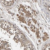 Anti-HTRA3 antibody produced in rabbit Prestige Antibodies® Powered by Atlas Antibodies, affinity isolated antibody, buffered aqueous glycerol solution