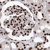 Anti-NUMA1 antibody produced in rabbit Prestige Antibodies® Powered by Atlas Antibodies, affinity isolated antibody, buffered aqueous glycerol solution