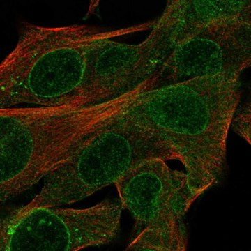 Anti-CYTL1 antibody produced in rabbit Prestige Antibodies&#174; Powered by Atlas Antibodies, affinity isolated antibody