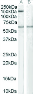 Anti-SPA1/SIPA1 antibody produced in goat affinity isolated antibody, buffered aqueous solution