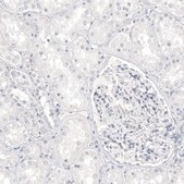 Anti-MLANA antibody produced in mouse Prestige Antibodies® Powered by Atlas Antibodies, clone CL12864, purified by using Protein A, buffered aqueous glycerol solution