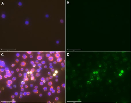 Anti-HHV-8 PF-8 Antibody, clone 11D1