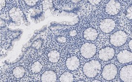 Anti-MMP14 Antibody, clone LEM-2/15.8 ZooMAb® Mouse Monoclonal recombinant, expressed in HEK 293 cells