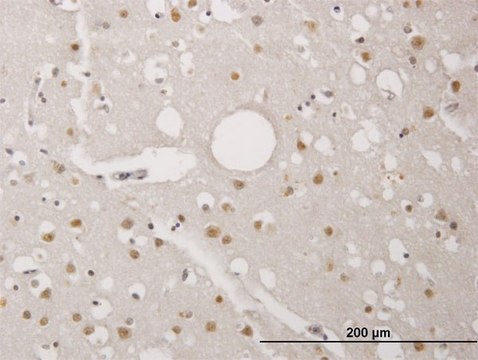 Monoclonal Anti-TP53RK antibody produced in mouse clone 2E8, purified immunoglobulin, buffered aqueous solution