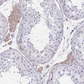 Anti-IFI44L antibody produced in rabbit Prestige Antibodies® Powered by Atlas Antibodies, affinity isolated antibody, buffered aqueous glycerol solution