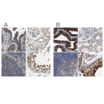 Anti-RUVBL1 antibody produced in rabbit Prestige Antibodies&#174; Powered by Atlas Antibodies, affinity isolated antibody, buffered aqueous glycerol solution, Ab2