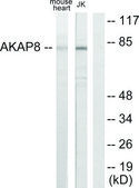 Anti-AKAP8 antibody produced in rabbit affinity isolated antibody