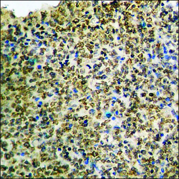 Anti-phospho-IKK-&#945; (pThr23) antibody produced in rabbit affinity isolated antibody