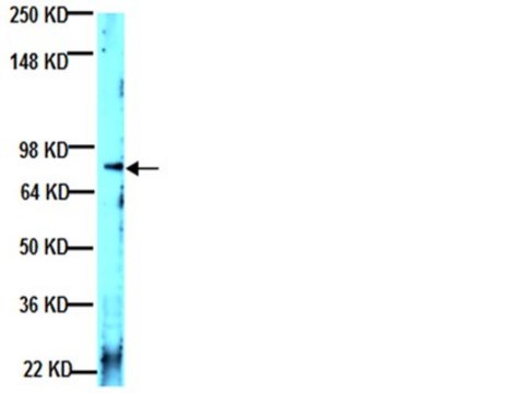 抗层粘连蛋白&#945;2抗体，克隆5H2 ascites fluid, clone 5H2, Chemicon&#174;