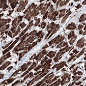 Anti-HADHB antibody produced in rabbit Prestige Antibodies® Powered by Atlas Antibodies, affinity isolated antibody, buffered aqueous glycerol solution