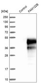 Anti-FAM122B antibody produced in rabbit Prestige Antibodies® Powered by Atlas Antibodies, affinity isolated antibody, buffered aqueous glycerol solution