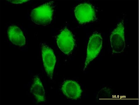 Anti-CYB5R3 antibody produced in mouse purified immunoglobulin, buffered aqueous solution