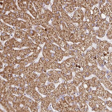 Anti-PDPK1 antibody produced in rabbit Prestige Antibodies&#174; Powered by Atlas Antibodies, affinity isolated antibody, buffered aqueous glycerol solution