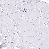 Monoclonal Anti-GAP43 antibody produced in mouse Prestige Antibodies® Powered by Atlas Antibodies, clone CL10884, purified antibody (Protein A)