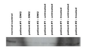 Anti-CNBP antibody produced in rabbit affinity isolated antibody