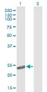 Anti-CRYBA2 antibody produced in mouse IgG fraction of antiserum, buffered aqueous solution