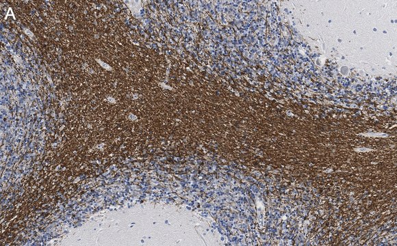 Anti-CNPase Antibody, clone 3N12 ZooMAb&#174; Rabbit Monoclonal recombinant, expressed in HEK 293 cells