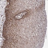 Anti-ZCCHC7 antibody produced in rabbit Prestige Antibodies® Powered by Atlas Antibodies, affinity isolated antibody, buffered aqueous glycerol solution