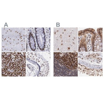 Anti-TERF2 antibody produced in rabbit Ab1, Prestige Antibodies&#174; Powered by Atlas Antibodies, affinity isolated antibody, buffered aqueous glycerol solution