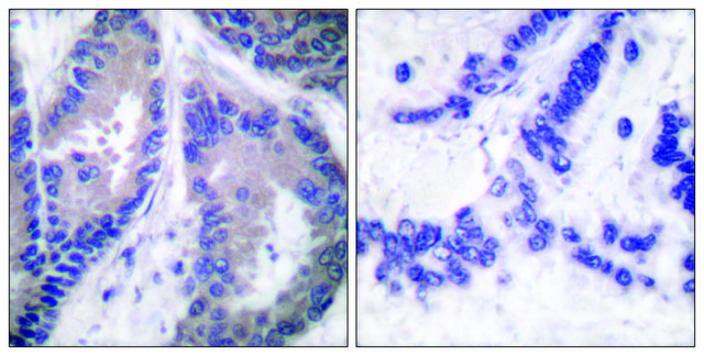 Anti-Collagen &#945;1 XVIII, C-Terminal antibody produced in rabbit affinity isolated antibody