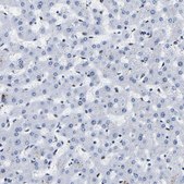 Anti-CCDC6 antibody produced in rabbit Prestige Antibodies® Powered by Atlas Antibodies, affinity isolated antibody, buffered aqueous glycerol solution, Ab1