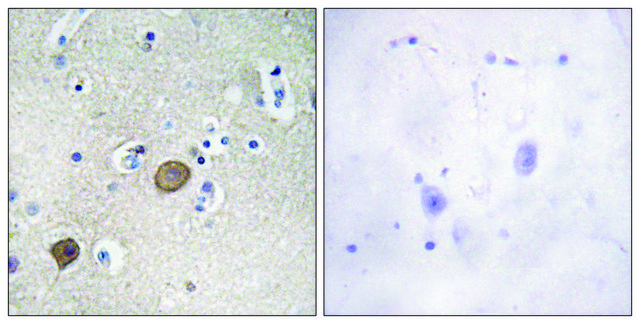 Anti-Catenin-&#945;1 antibody produced in rabbit affinity isolated antibody