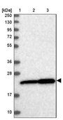 Anti-EXOSC1 antibody produced in rabbit Prestige Antibodies® Powered by Atlas Antibodies, affinity isolated antibody, buffered aqueous glycerol solution