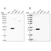 Anti-RPL8 antibody produced in rabbit Prestige Antibodies® Powered by Atlas Antibodies, affinity isolated antibody, buffered aqueous glycerol solution