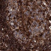 Anti-EML4 antibody produced in rabbit Prestige Antibodies® Powered by Atlas Antibodies, affinity isolated antibody, buffered aqueous glycerol solution