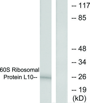 Anti-60S Ribosomal Protein L10, N-Terminal antibody produced in rabbit affinity isolated antibody